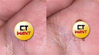 男友咳出「詭異生物」　全網見畫面抖爆