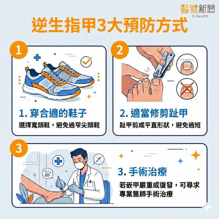 逆生性指甲3大預防方式。（圖／醫健新聞網提供）