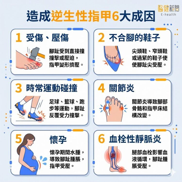 逆生性指甲是「凍甲」？與甲溝炎不同？皮膚科醫提6大成因。（圖／醫健新聞網提供）