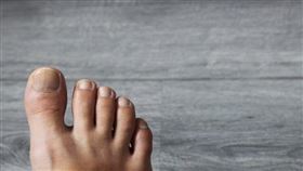 逆生性指甲是「凍甲」？與甲溝炎不同？皮膚科醫提4大成因、2大治療方式。（圖／醫健新聞網提供） 