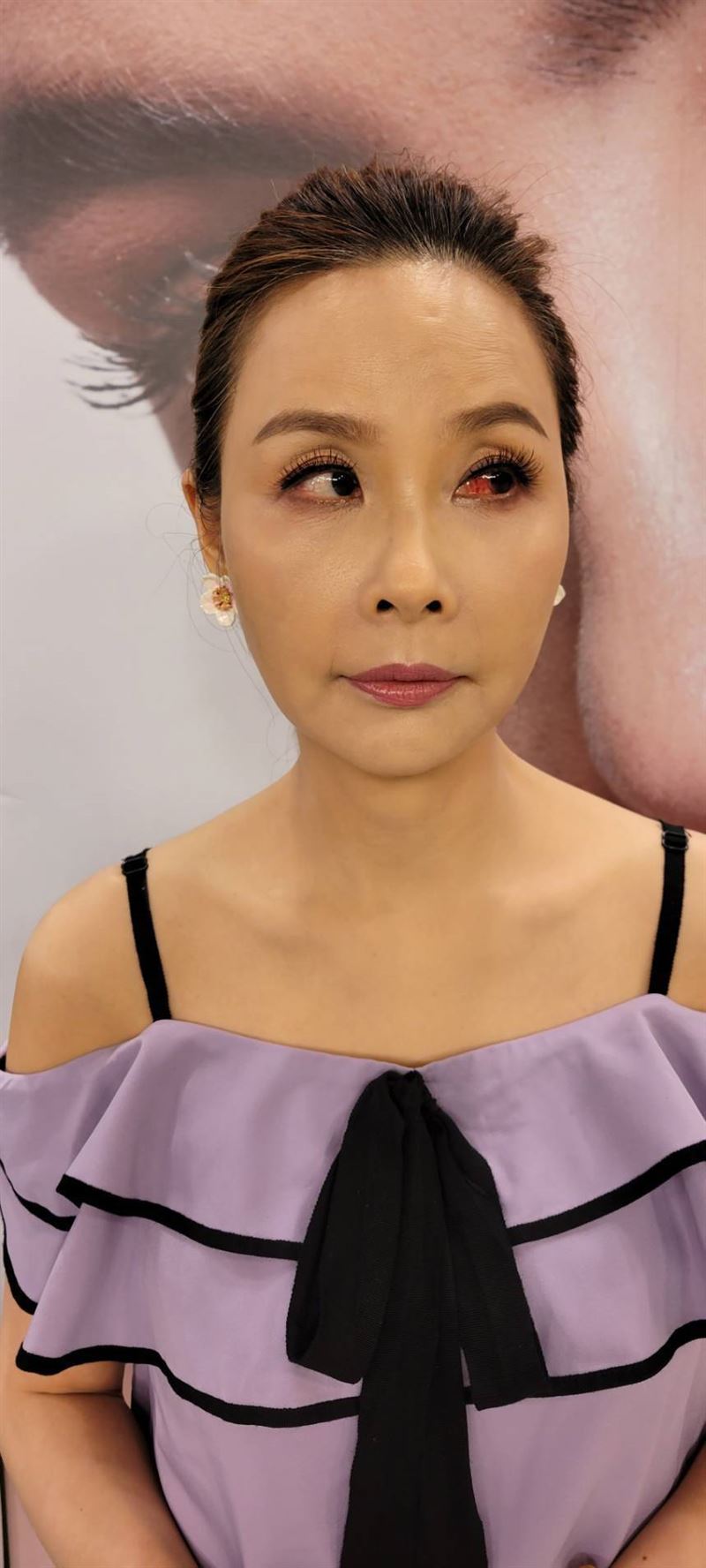許聖梅因為眼中風,右眼都是紅血絲。(圖/本人提供)