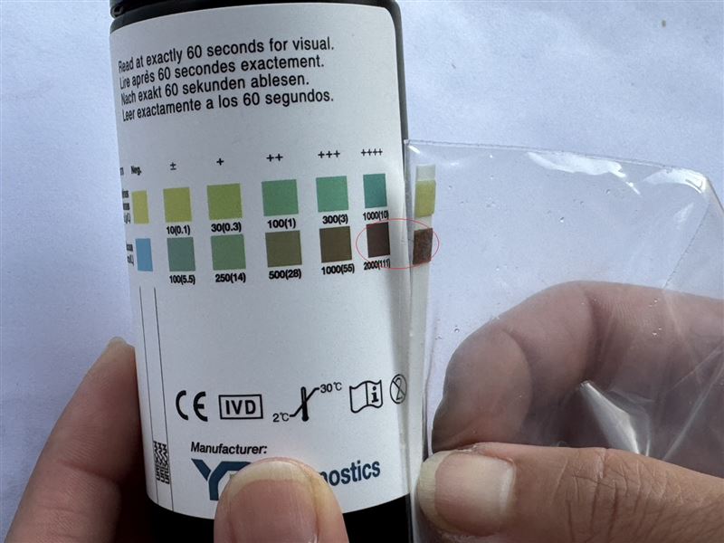 李男長期口渴未重視，確診糖尿病後用藥，並調整作息與飲食，透過監測發現含糖飲食易使血糖飆升，已改善習慣並加強控制，避免併發症風險。（圖／衛福部彰化醫院提供）