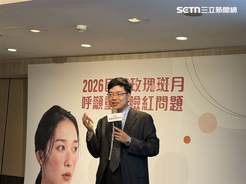 邱品齊說明，玫瑰斑最典型的表現是「中臉部位長期反覆發紅」，範圍多集中在額頭、鼻子、臉頰與下巴，形成所謂的「干字型」區域。（圖／記者蔣季容攝影）