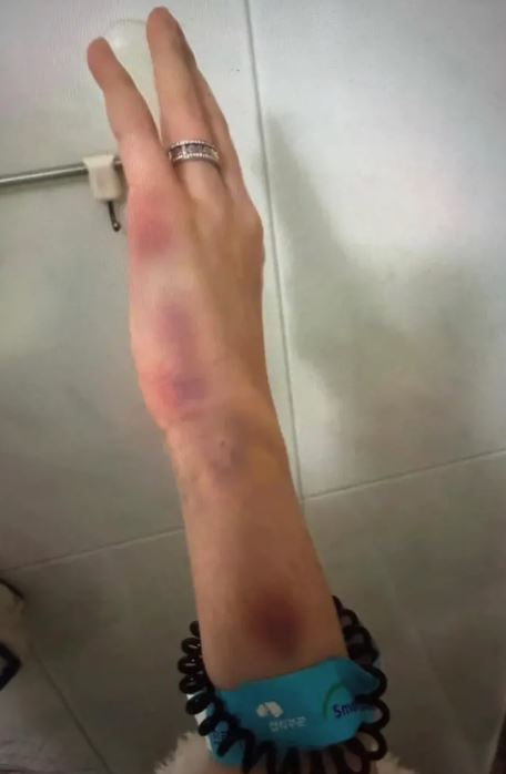 金政勳妻子揭遭暴力對待。（圖／翻攝自Theqoo）