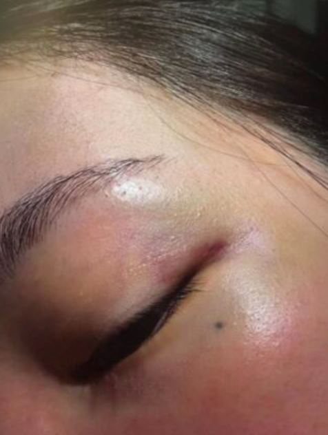 引發關注的是，一名自稱其配偶的女性於今（18）日公開指控，內容涉及長期家暴與性暴力等嚴重情節，並附上傷勢照片與相關說法，震撼外界。（圖／翻攝自theqoo）