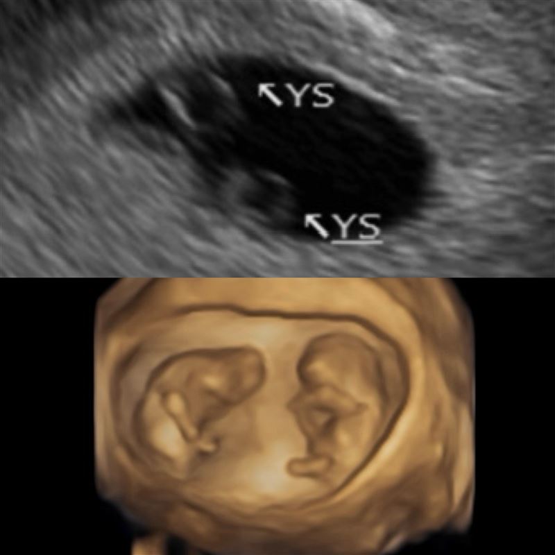 鄭家純證實懷孕。（圖／翻攝自臉書）