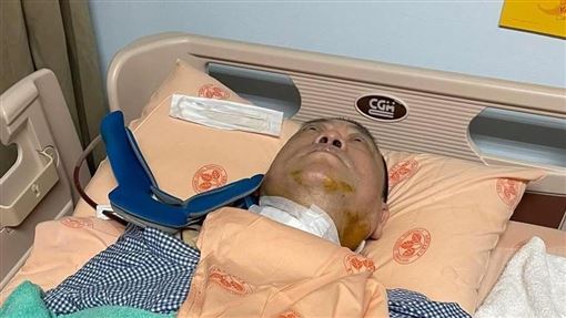 66歲孫德榮突出事了　急診續命病況曝光