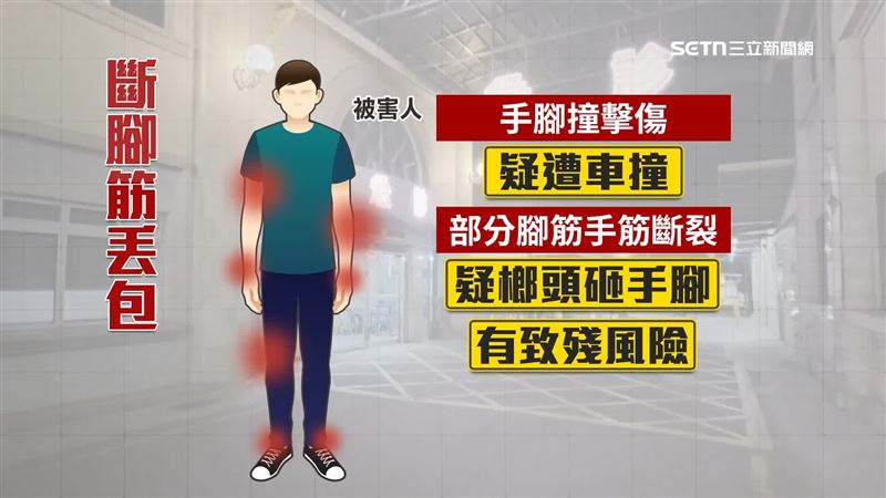 男子手筋腳筋遭榔頭重擊，差點全斷，不排除有致殘風險