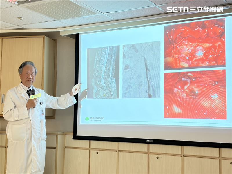 黃金山醫師表示，該疾病恐反覆發作，如林女士歷經5次重大手術治療。除了手術外，近年國際間新型標靶藥物問世，可望為患者帶來新的治療契機。（圖／記者簡浩正攝影）