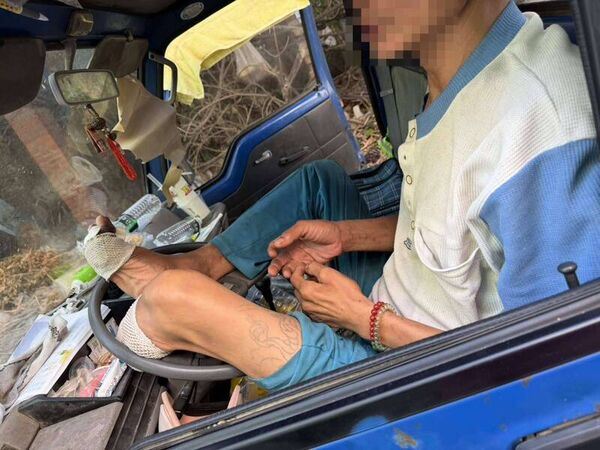 彰化男因車禍導致左腿、右腳拇指被截肢。（圖／賴清美提供）