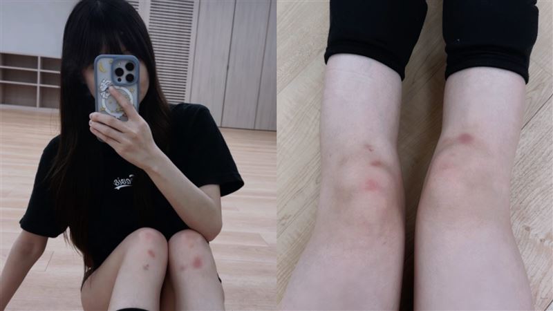 富邦啦啦隊Fubon Angels成員維心21日證實半月板和韌帶的撕裂傷。（圖／翻攝自維心Threads）