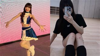 富邦啦啦隊傳傷兵　她深夜突PO雙膝傷照