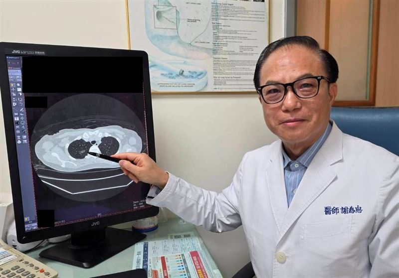 謝為忠副院長呼籲，肺癌不可怕，關鍵在於及早發現、及早介入治療。（圖／大千綜合醫院提供）