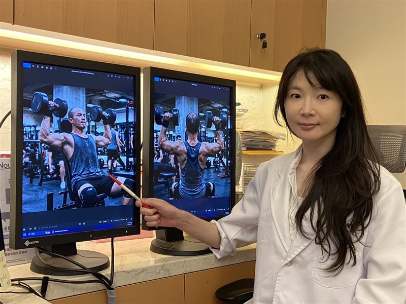 網路流傳做重訓健身會加速禿頭？皮膚科鍾佩宜醫師引用最新研究駁斥。(圖／茂盛醫院提供)