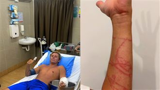 最毒水母纏身！澳男劇痛如油淋：我會死？