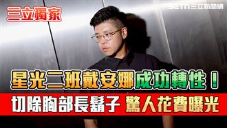 獨／女星切胸部長鬍子變男生！驚人花費曝