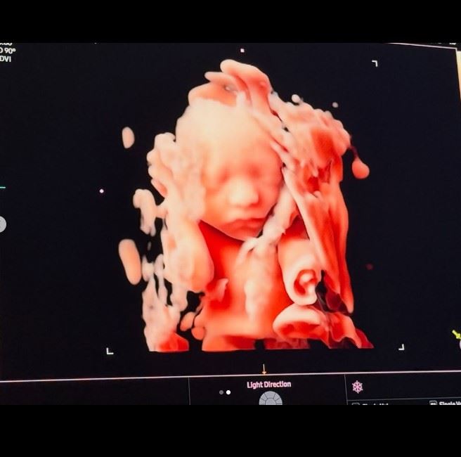 宋承炫曬超音波照宣布即將升格為爸爸。（圖／翻攝自IG @soow456）