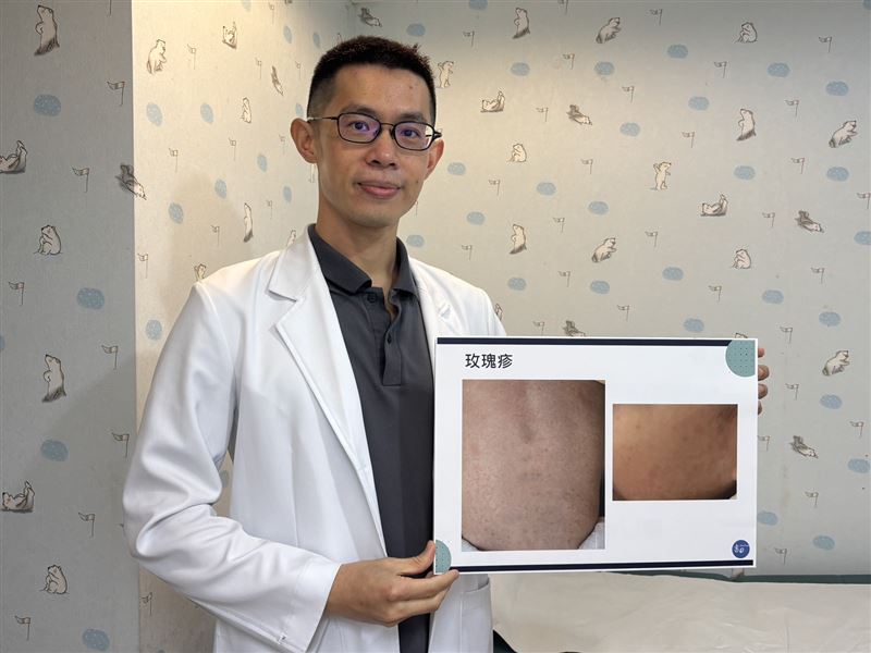 書田診所小兒科主任醫師蘇軏表示，造成玫瑰疹的病毒不只一種。（圖／書田診所提供）