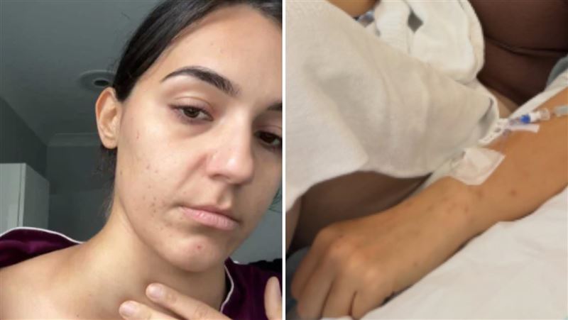 澳洲女子皮膚長期搔癢讓她睡不著、抓出很多傷口，一驗發現患淋巴癌。（圖／翻攝自IG@sumbulari）
