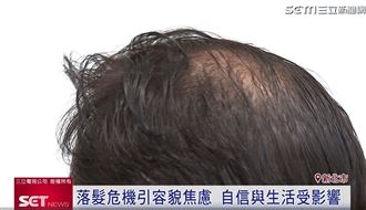 掉髮拉高視覺年齡?！養髮慕絲成熱門趨勢