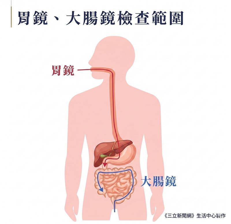 大腸癌長年位居於我國發生率第一的癌症，若民眾從未做過腸胃鏡檢查，醫師建議30歲前，可進行第一次完整的健康檢查。（圖／記者許雅惠製作）