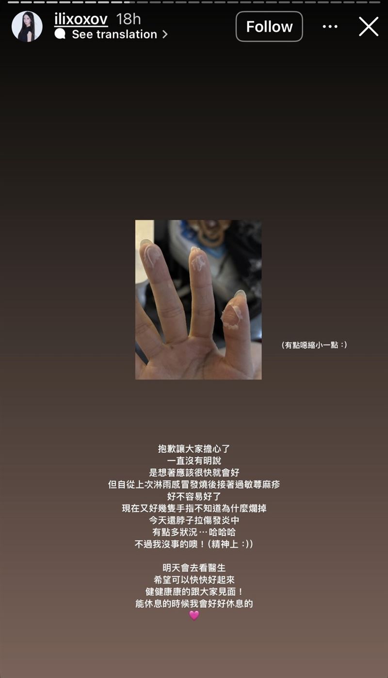 一粒在IG限時動態發文透露近期身體狀況。（圖／翻攝自IG @ilixoxov）