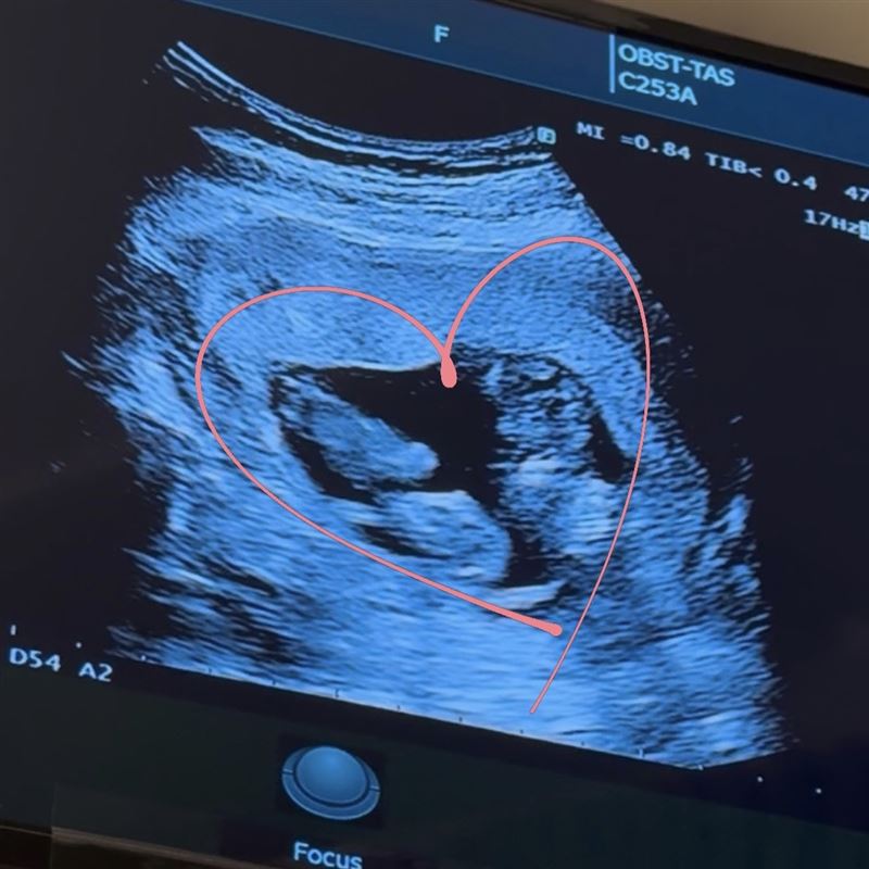 鄭家純日前驚喜宣布懷雙胞胎。（圖／翻攝自鄭家純臉書）