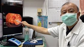 60多歲婦人，3個月甩肉，狂瘦10公斤，以為減肥成功，卻罹大腸癌3期(圖／大甲李綜合醫院提供)