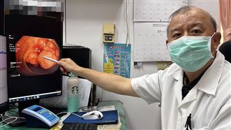 18歲竟大腸癌三期！醫揭這檢查是保命關鍵