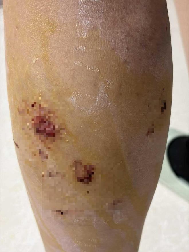 女大生返回宿舍途中遭4、5隻流浪狗追咬。（圖／翻攝微博）