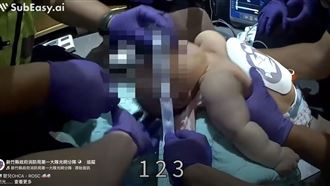 9月女嬰沙發OHCA　救護員急救2分鐘現奇蹟