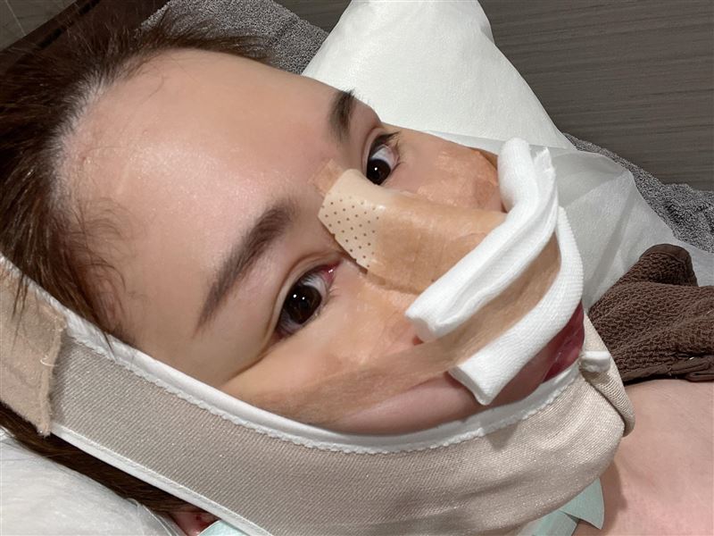 辛尤里日前在社群透露，自己已赴日本接受多項整形手術，包含隆鼻等療程，並曬出臉部大範圍包紮的術後畫面。（圖／翻攝自辛尤里FB）