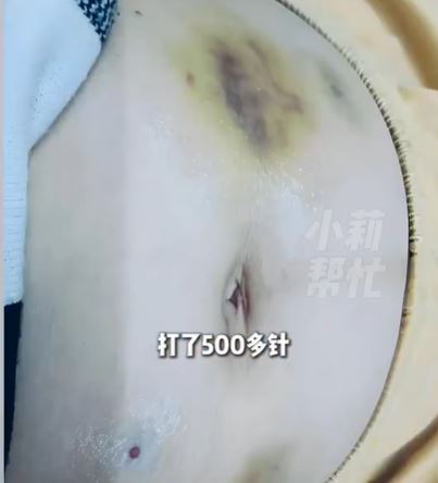 王女透露，她為懷孕做了多次試管嬰兒手術。（圖／翻攝自小莉幫忙）