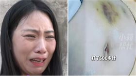 老婆為生子「挨500針試管」 老公竟出軌20女還擄走小孩（圖／翻攝自小莉幫忙）