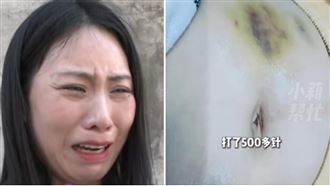 妻生子挨500針試管 尪出軌20女再擄走小孩