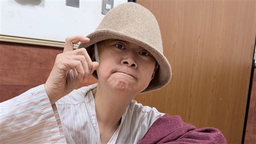 王月開顱近況曝　公開傷疤：留下來的證明
