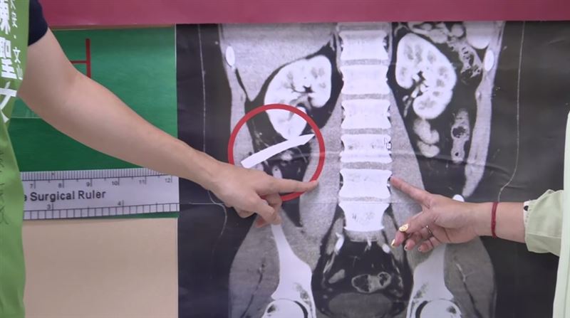 陳聖文體驗密室逃脫，過程中竟遭9公分壓克力銳片刺入腹部，差點傷及腎臟（圖／翻攝畫面）