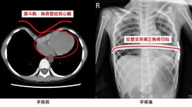 中國醫藥大學新竹附設醫院胸腔外科醫師謝義山。（圖／中國醫藥大學新竹附設醫院提供）