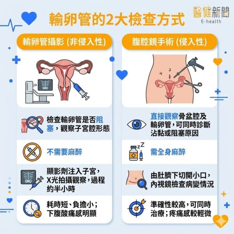 如何檢測輸卵管是否阻塞？2種常用檢查方式一次了解！（圖／醫健新聞網提供）