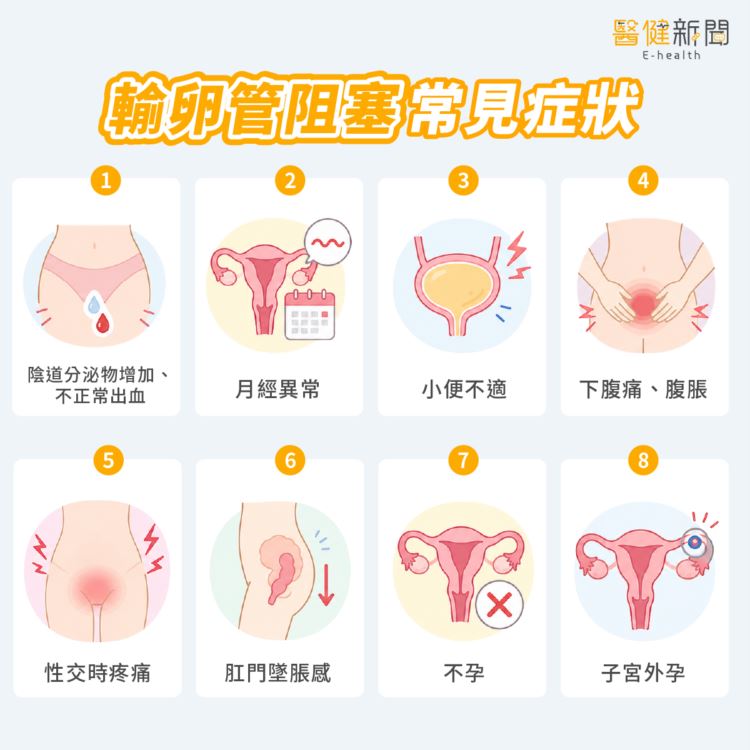 一般而言，輸卵管阻塞不會有明顯症狀，不過若有以下這些症狀出現時，建議應儘早接受檢查。（圖／醫健新聞網提供）