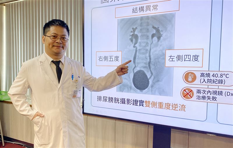 8歲盧小妹因輸尿管銜接膀胱位置異常，導致雙側嚴重尿液逆流。(圖／臺中榮總提供)