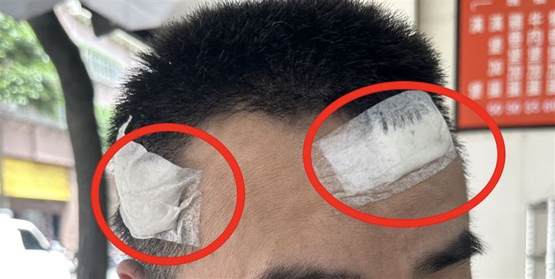 民眾取車時檢查車輛狀況，卻被露在牆外的蛇籠弄傷頭部，縫了十針。（圖／張嘉玲提供）