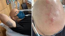 吳鳳驚爆病倒住院　長滿帶狀皰疹病況曝光