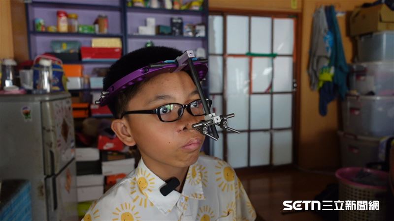 戴著牽引器的劉證就像電影中的「機器男孩」，雖然難免遇到異樣眼光，但劉證靦腆地說，每個人都有自己的特點，選擇做自己就好，希望透過自己的故事讓大家了解到三件事，那就是：找到有共同興趣的朋友、不要把情緒悶在心裡，以及不要在意別人的評價。（圖／記者張雅筑攝）