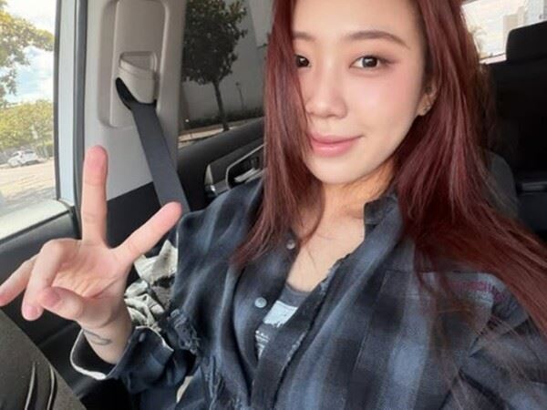李泳知術後最新近況曝光，被粉絲大讚「美到認不出來」。（圖／翻攝自IG @youngji_02）