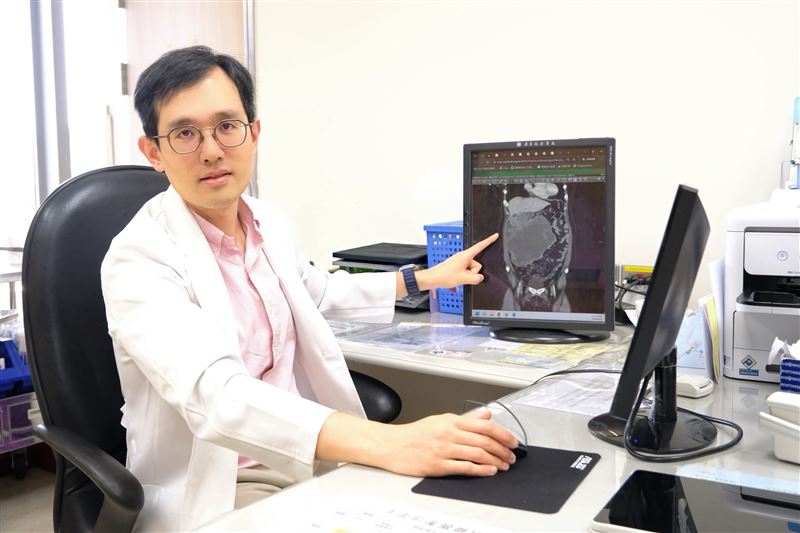 許志豪醫師表示，腸胃道基質瘤症狀隱匿，若出現不明原因貧血、黑便或腹部異常腫塊，應提高警覺並儘速就醫。（圖／亞東醫院提供）