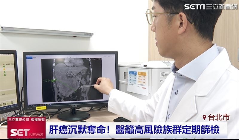 晚期肝癌不受限 口服藥物穩定生活與療效