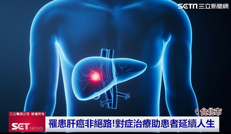 罹患肝癌並非等於步入絕境，患者積極配合、對症治療，仍能延續生命