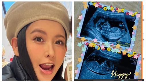 42歲蝴蝶姐姐定居上海懷雙胞胎　性別曝光