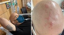 吳鳳染惡疾治療現況曝　讚台灣：健保完善